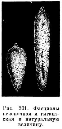 Krónikus fascioliasis