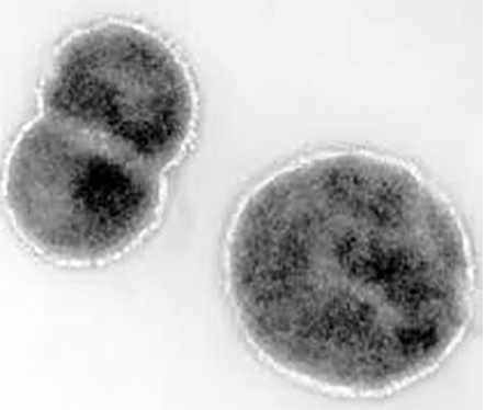   Lentisphaerae